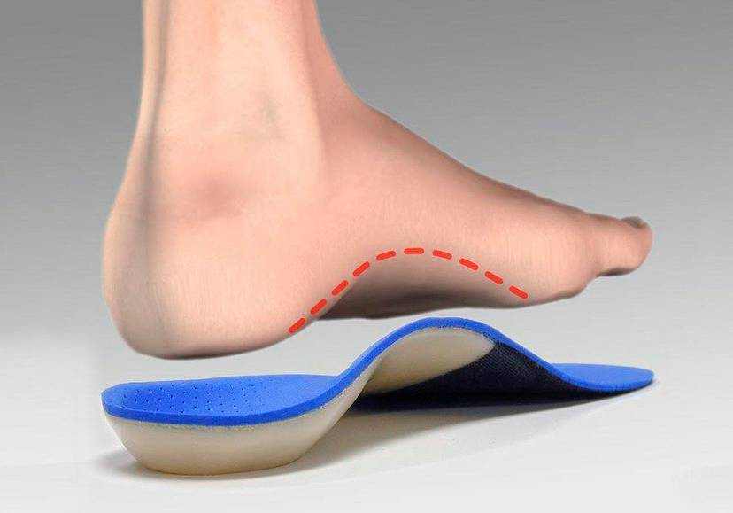 Arch Support - Orthotic