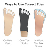 Correct Toes