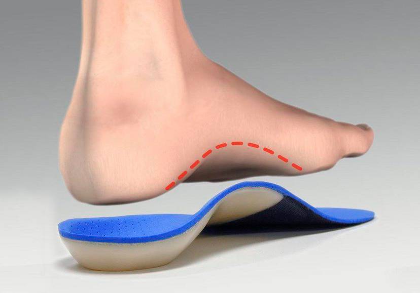Arch Support Orthotic